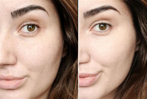 chanel best foundation|chanel foundation before and after.